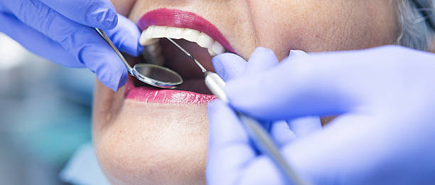 Best Emergency Dental Care for Sports Injuries in Arapahoe, NE